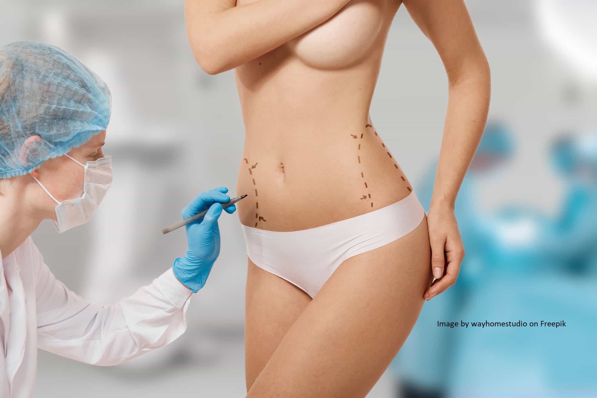 Woman getting ready For Lipomatic as a weight loss method