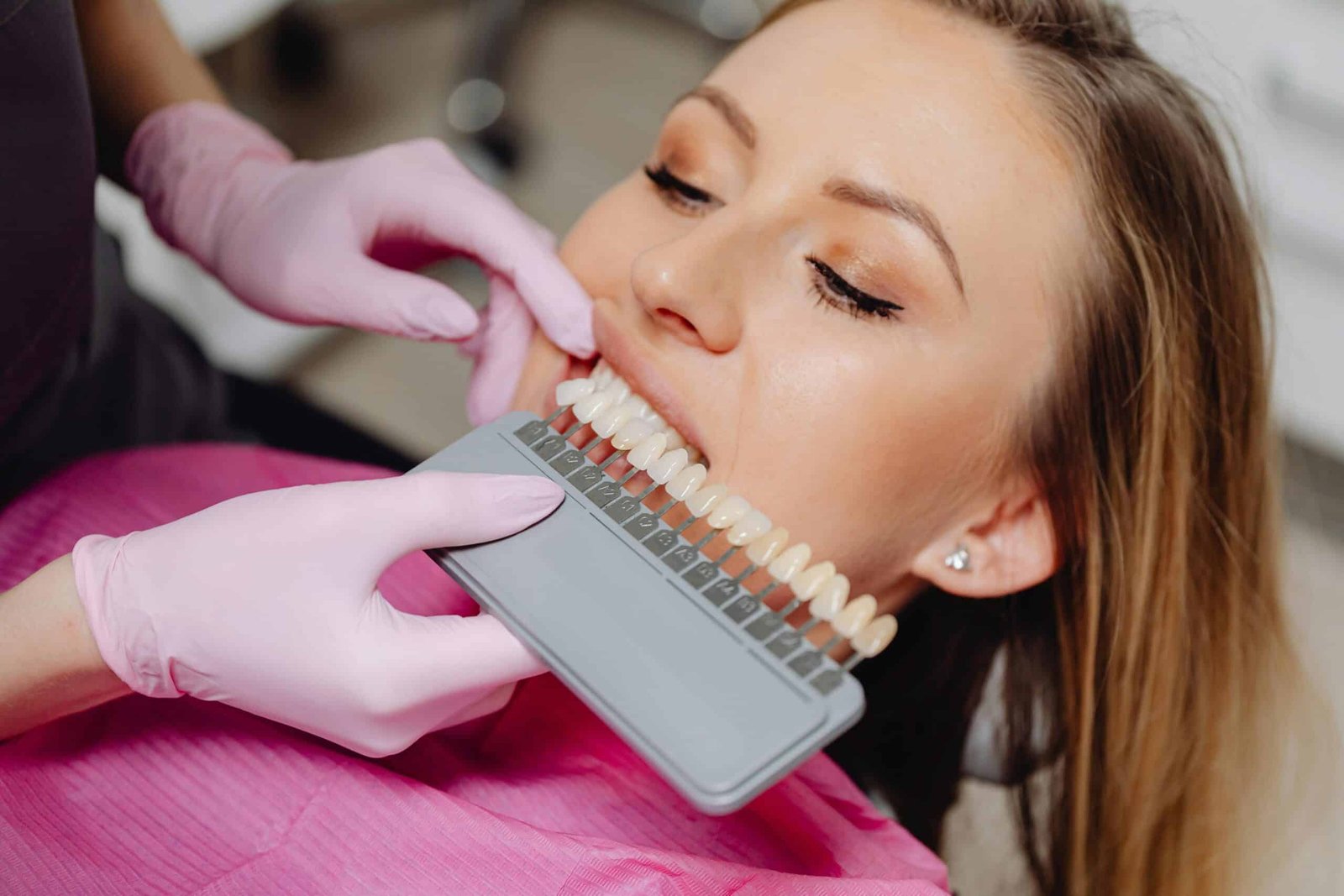 Composite veneers vs laminate veneers. which one is and which color is better