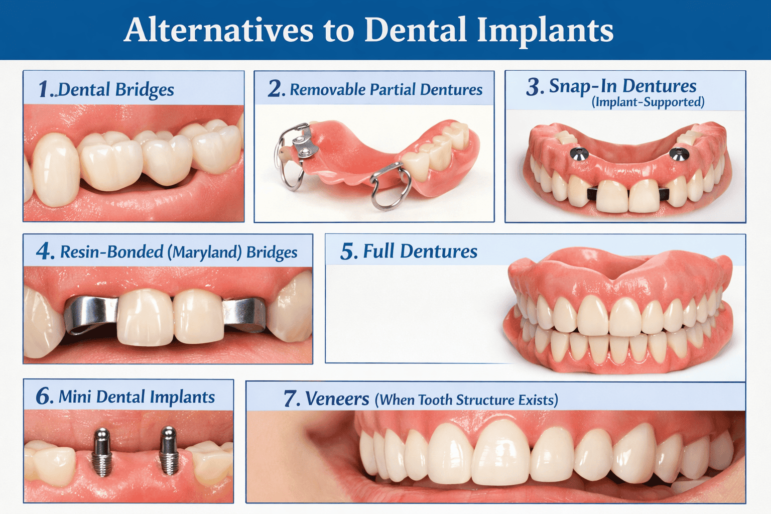 Alternatives to dental implants from dental bridges to veneers and dentures